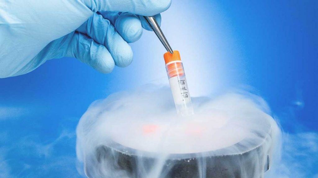 Oocyte Freezing at Wish Fertility